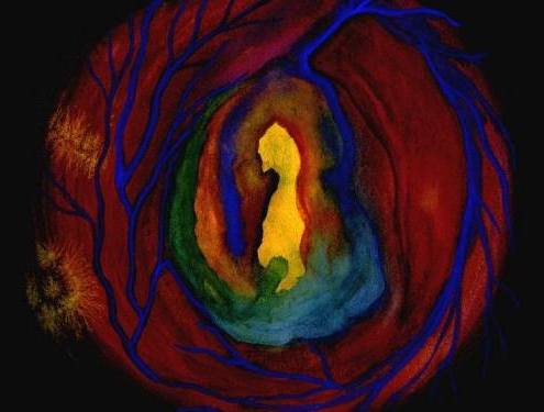 From the Body of Medusa, painting by Mary Lynn Richardson